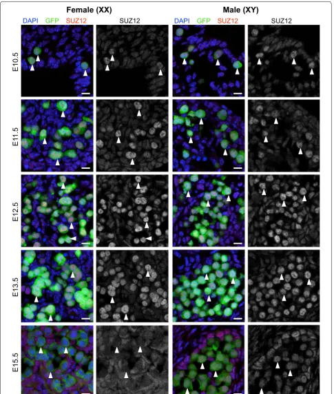 Fig. 4 SUZ12 is enriched in the nucleus of E10.5–E13.5 male and female germ cells. Confocal images of SUZ12 immunofluorescence in sections of XX and XY E10.5–E11.5 bipotential gonad and E12.5–E15.5 developing ovaries and testes