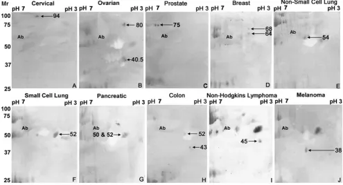 Fig. 1 2-D gel western blot of ENOX2 isoforms comparing poolednon-cancer (a) and pooled cancer (b) patient sera