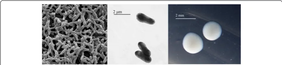 Fig. 1 Images of Rhizobium leguminosarum bv. viciae strain GB30 using scanning (Left) and transmission (Center) electron microscopy and theappearance of colony morphology on ½LA solid media (Right)