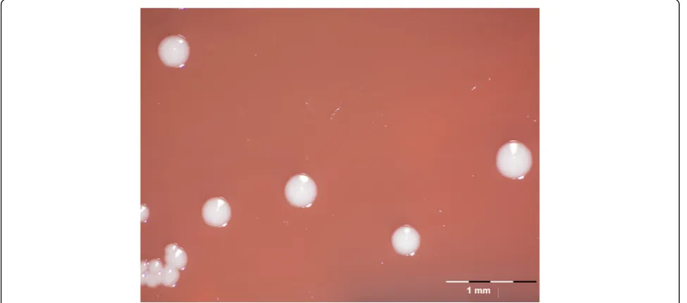 Figure 2 Gram stain of A. equuli subsp. equuli ATCC 19392T at 1000 X magnification.