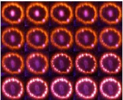 Figure 2. The image of SN 1987A as observed by HST from 1995 to 2006 [16]. 