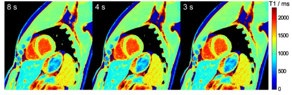 Figure 3. Myocardial T 1 maps for different measurement durations. Single-shot inversion recovery FLASH was performed at 43 ms temporal resolution (19 spokes) for durations of 8, 4 and 3 s.