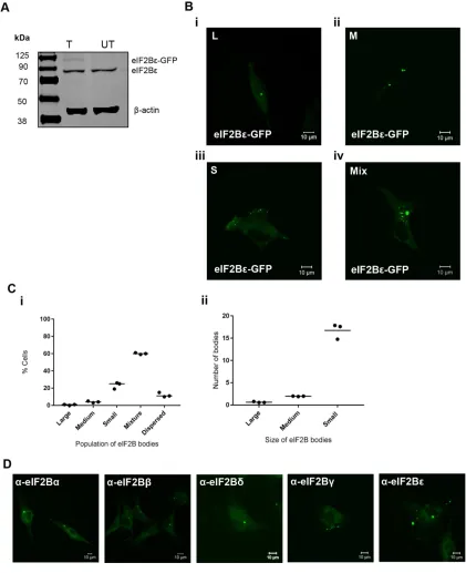 FIGURE 1: eIF2Bε localizes to cytoplasmic bodies in U373 cells. (A) eIF2Bε-GFP was expressed in U373 cells, confirmed by Western blot analysis