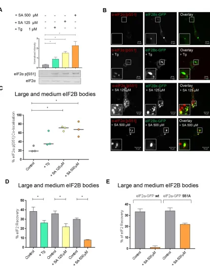 FIGURE 4: In the presence of Tg- or SA-induced cellular stress, phosphorylated eIF2α localizes to large and medium eIF2B bodies decreasing movement of eIF2 through these bodies