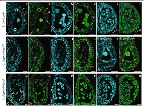 Figure 8 Confocal microscopy of longitudinal sections of anther sacs from hermaphroditic, male and female flowers of Lepidiumtreated with TUNEL assay and controls