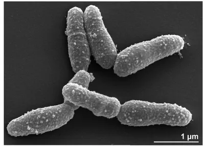 Figure 2. Scanning electron micrograph of A. haemolyticum strain 11018T