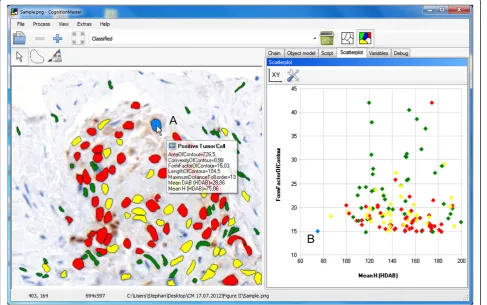 Figure 2 Image of Ki67 [18] stained breast cancer tissue displayed inScatter plot diagram displaying two features for all image objects (cells) marked in the image on the left: the mean haematoxylin intensity in theH-DAB stain (x-axis) and a form factor gi