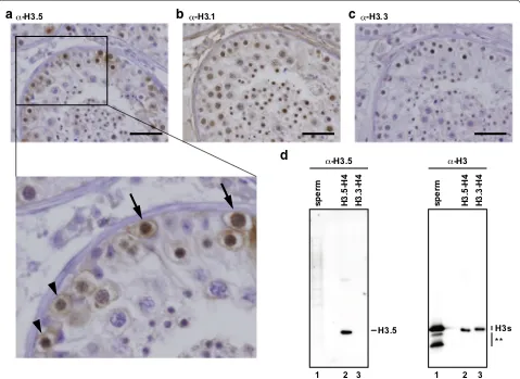 Fig. 7 H3.5 exists in human testicular cells within seminiferous tubules. a–c Human testis sections immunohistochemically stained with the anti-H3.5 (a), anti-H3.1 (b), and anti-H3.3 (c) monoclonal antibodies