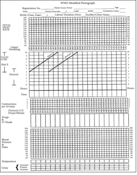 Figure 1: The modified WHO partograph. 
