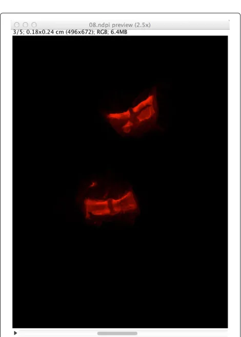 Figure 2 A typical session using ImageJ and the NDPITools plugins. A NDPI file has been opened with the NDPITools plugins and it is displayedas a preview image (image at largest resolution which still fits into the computer’s screen) — top window