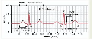Fig 2. Morphology of ECG Wave 