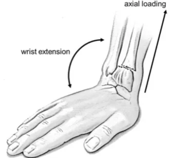 Figure 11.3: Wrist loading during fall (from Michel et al. 2013) 