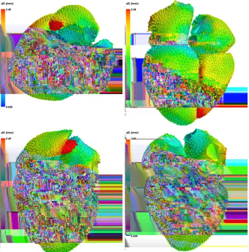 Fig. 6. Spatial distribution of the surface errors d S averaged over a subgroup of N = 24 patients (segmented with the same mesh) at the same heart phase (diastasis).