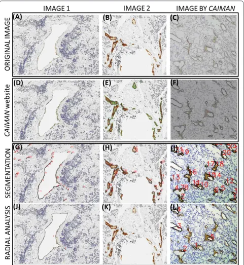 Figure 2 Comparison of the segmentation quality between the developed tool and CAIMAN application.B are images from our database and C is an example image provided by CAIMAN with a less well-lit caption