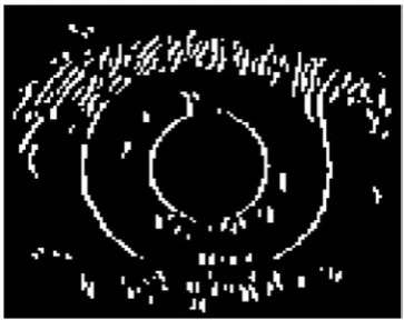 Figure 2: Canny edge detection 
