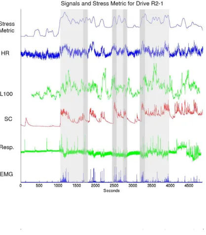 Fig. 5. This figure shows an illustration of the physiological data collected from the respiration, heart rate, L100 spectral ratio, the skin conductivity (SC) from the hand and the electromyogram (EMG) along with the stress metric derived from the video t