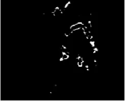 Figure 5. Image after segmentation and optic disc removal 