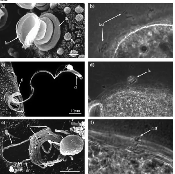 Fig. 2   Morphology comparison of lateral attachment structures by SEM and light microscopy