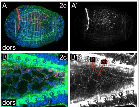 Figure 7 Ectomesodermal descendants from 2cstaining shown in tichannel image in . (A, B) Z-stacks of merged, confocal images from a dorsal (dors) view through a late stage 6 (A) or a stage 8 (B) larva after labeling micromere 2c