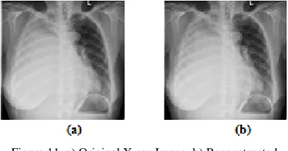 Figure 10. a) Original MRI_Spine Image, b) Reconstructed  MRI_Spine Image using proposed method   