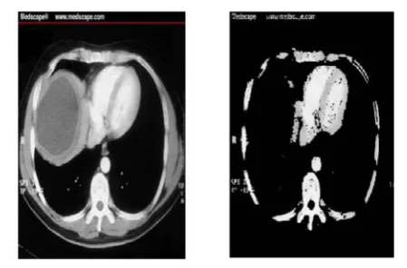 Figure 9: Original Image and Segmented Foreground Image [9]