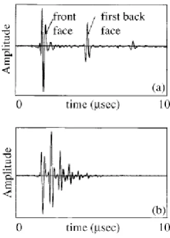 Figure 2.2: Ultrasonic ‘A-scan’ of composite material using a normal incidence 