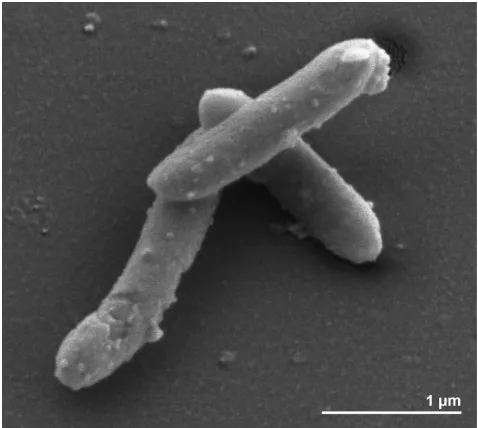 Figure 2. Scanning electron micrograph of FlGlyRS. glycolicus T 