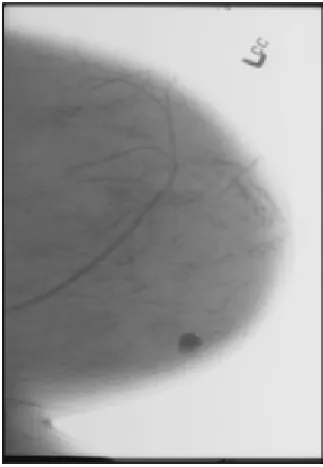 Fig 1 Image is with noise elements 