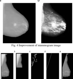 Fig. 3 Segmentation process of mammogram image 