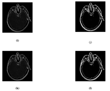 Figure 2. Results of implementation of  different structuring elements a) Se1 b) Se1 with thresholoding c)Se2 d) Se2 with thresholding e) Se3 f) Se3 with thresholding g) Se4 h) Se4 with thresholding i) Se5 j) Se5 with thresholding k) Se6 l) Se6 with thresholding 