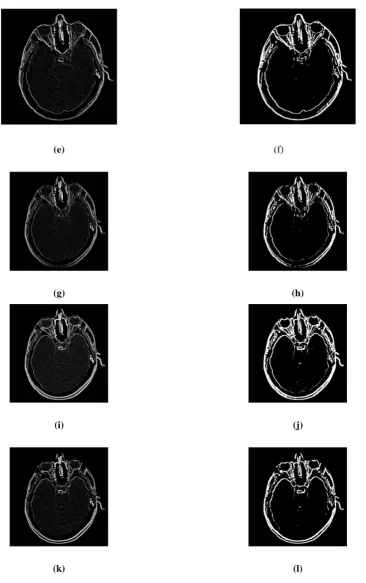 Figure 3. Results of implementation of  different structuring elements a) Se7 b) Se7 with thresholding c)Se 8 d) Se8 with thresholding e) Se9 f) Se 9 with thresholding g) Se10 h) Se10 with thresholding i) Se 11 j) Se11 with thresholding k) Se12 l) Se12 with thresholding  Se5 1.5917 