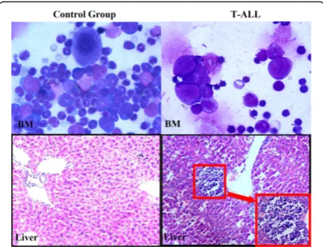 Figure 1 Morphology of cells of bone marrow smear and liver.Morphology of cells of bone marrow was studied under microscopy(Wright-Giemsa, ×1000) and liver was inspected for signs ofleukemic infiltration (HE, ×400)