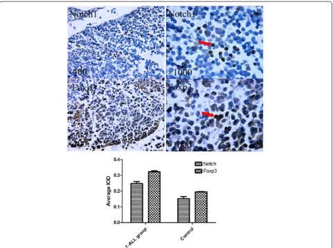 Figure 4 Foxp3 expression in Jurkat cells and PBMCs. The expression of Foxp3 in Jurkat cells and PBMCs was analyzed by flow cytometry.Foxp3-expressing jurkat cells were much more than Foxp3-expressing PBMCs (P < 0.05).