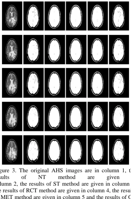 Figure 3. The original AHS images are in column 1, the results of NT method are given in column 2, the results of ST method are given in column 3, the results of RCT method are given in column 4, the results of MET method are given in column 5 and the resu
