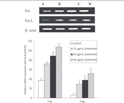 Figure 6 Effect of β-elemene on Fas and FasL mRNA expression in HepG2 cells. HepG2 cells were treated with various concentrations ofβ-elemene (10, 20 and 40 μg/mL) for 48 h, and then the mRNA expression of Fas and FasL were measured by RT-PCR assay