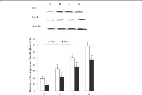 Figure 7 Effect of β-elemene on Fas and FasL protein expression in HepG2 cells. HepG2 cells were treated with various concentrations ofβ-elemene (10, 20 and 40 μg/mL) for 48 h