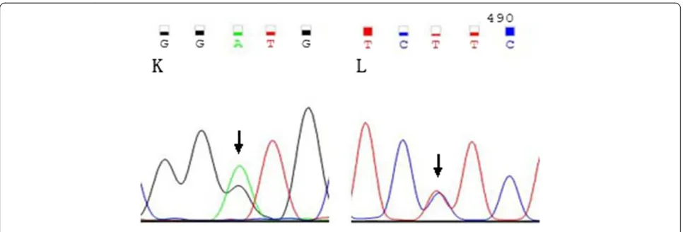 Figure 2 Sequencing results for patient 89, the double point DNMT3A mutation was K: 1906 G > A,L:2191 T > C.