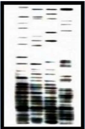 Figure 2.  DNA patterns observed in RFLP analysis. 