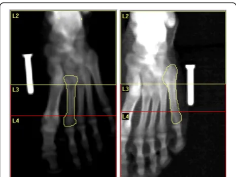 Fig. 1 Representative example of DXA analysis of the regions of interestfrom the lateral and medial scans