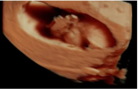 Figure 6: Nine week pregnancy. 