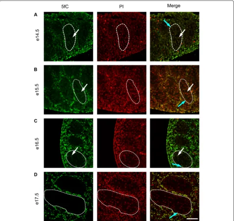 Figure 5 Immunofluorescence showing localisation of 5fC between e14.5 and e17.5. One seminiferous cord is shown outlined in eachimage; germ cells are indicated by white arrows and somatic cells within the seminiferous cord are indicated by blue arrows