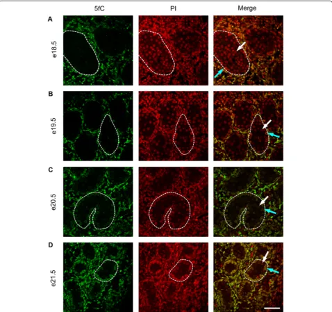 Figure 6 Immunofluorescence showing localisation of 5fC between e18.5 and e21.5. One seminiferous cord is shown outlined in eachimage; germ cells are indicated by white arrows and somatic cells within the seminiferous cord are indicated by blue arrows