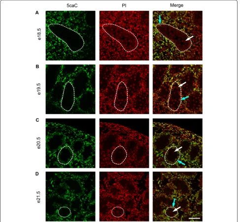 Figure 8 Immunofluorescence showing localisation of 5caC between e18.5 and e21.5. One seminiferous cord is shown outlined in eachimage; germ cells are indicated by white arrows and somatic cells within the seminiferous cord are indicated by blue arrows