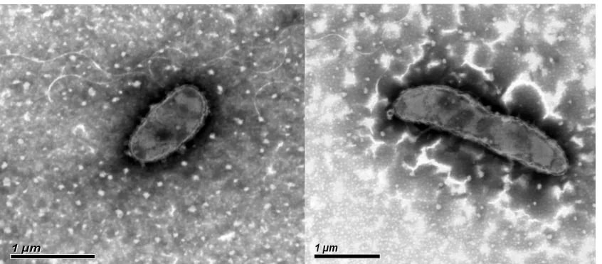 Figure 1 Transmission electron micrograph of  Dyadobacter tibetensis (T) Y620-1 