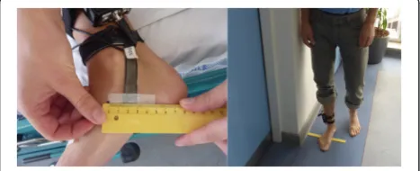 Fig. 2 Illustration of the measurement of navicular bone height and medial navicular position in images (3D SHARC sequences) obtained bypMRI in supine and standing position respectively