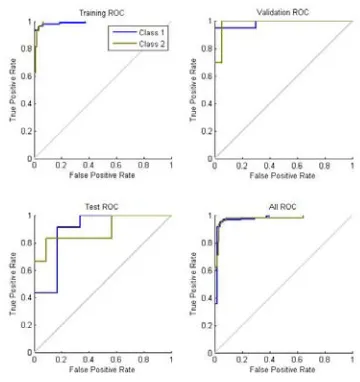 Figure. 5  Error histogram of MLP-FFN for Bank Note Authentication dataset. 