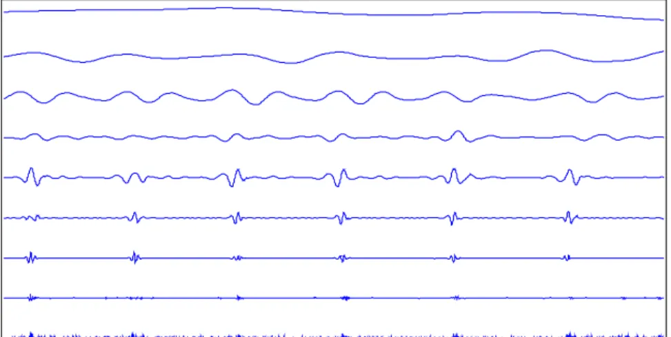 Figure 6:  The Reconstruction components of original ECG signal  