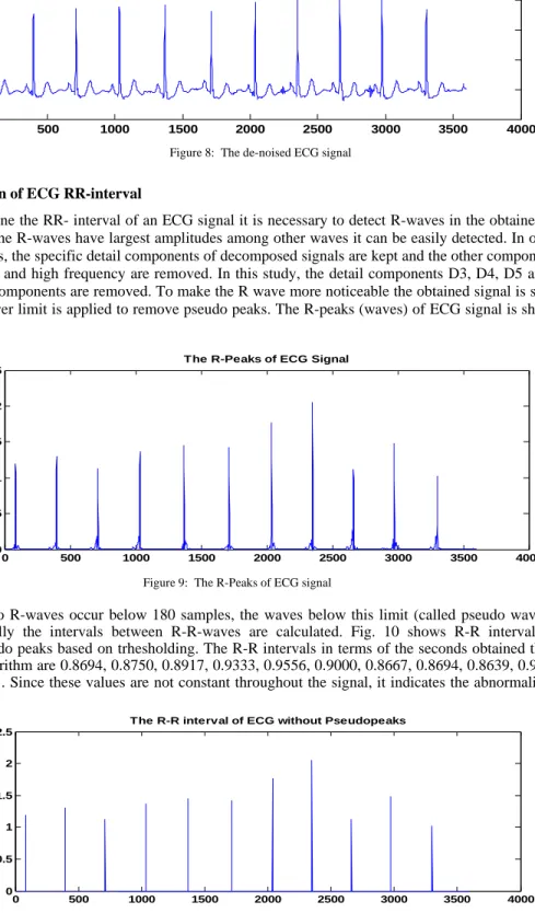 Figure 10:  The R-R interval ECG signal without Pseudo Peaks 