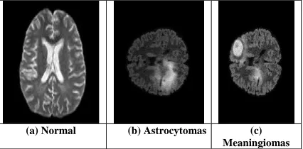 Fig. 1: A Magnetic Resonance Imaging (MRI) of the brain  