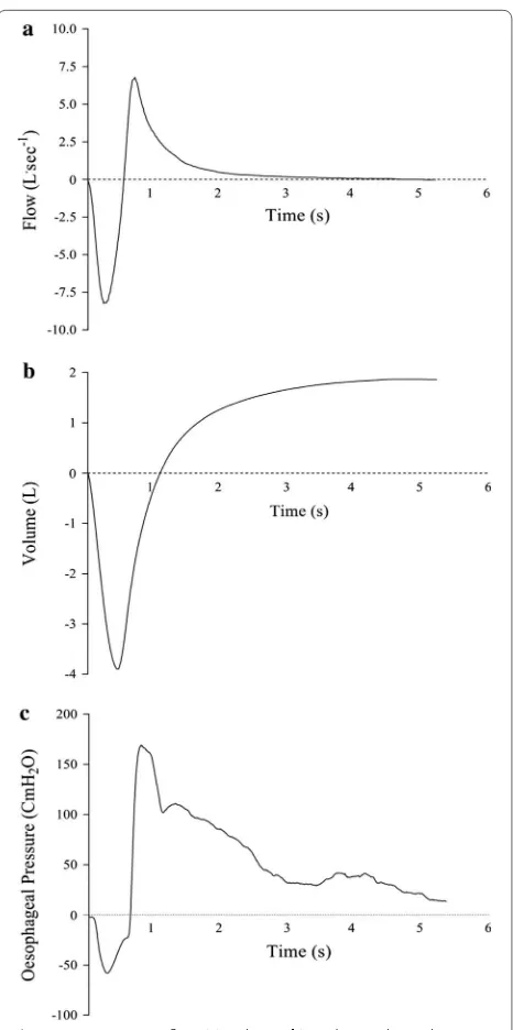 Fig. 1 Representative ﬂow (a), volume (b), and oesophageal pressure (c) traces from a single subject performing an FVC manoeuvre